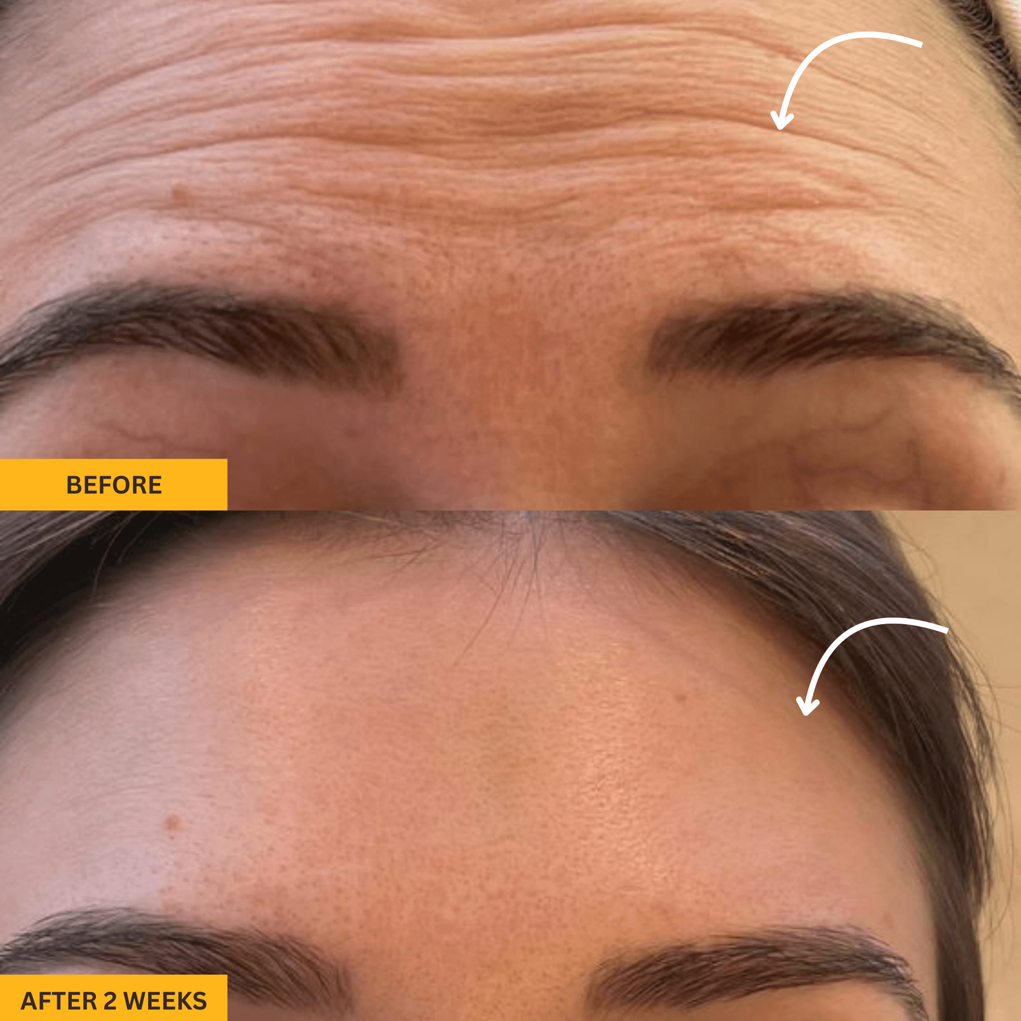 Valéa Lymphatic Brush