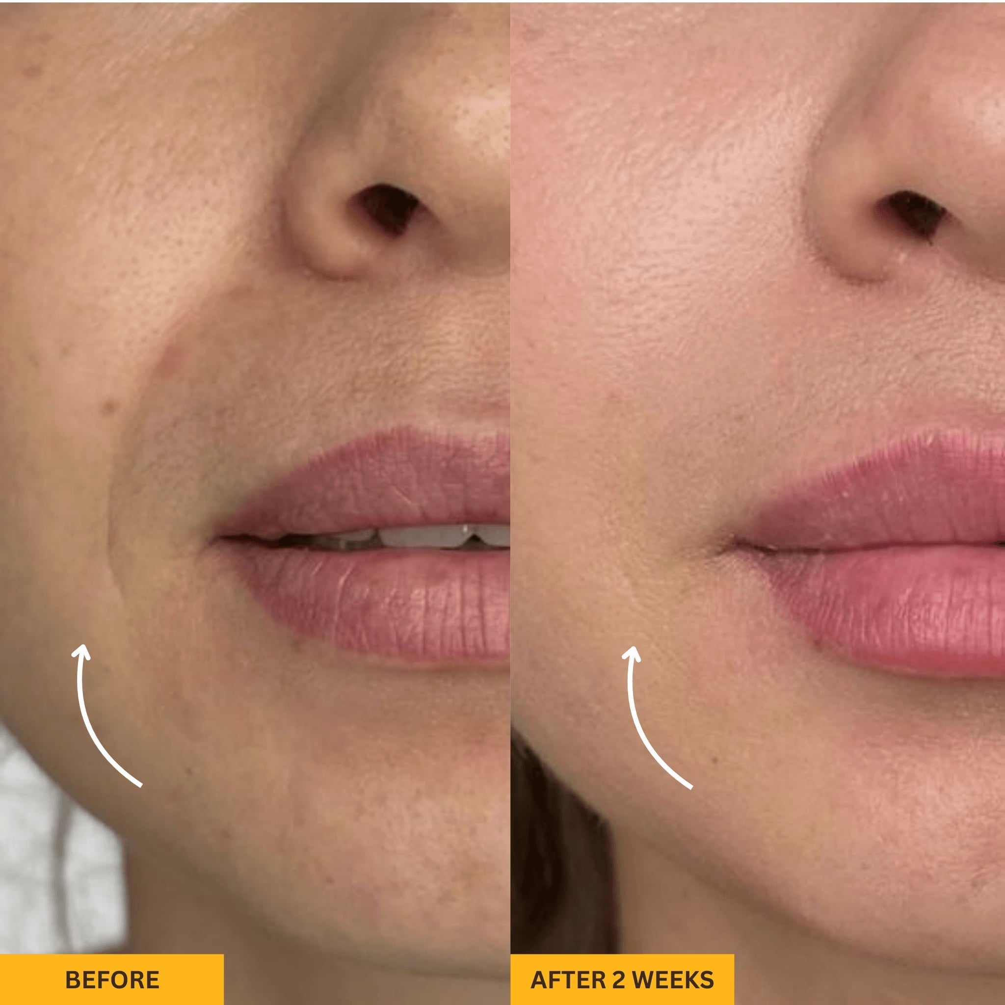 Valéa Lymphatic Brush