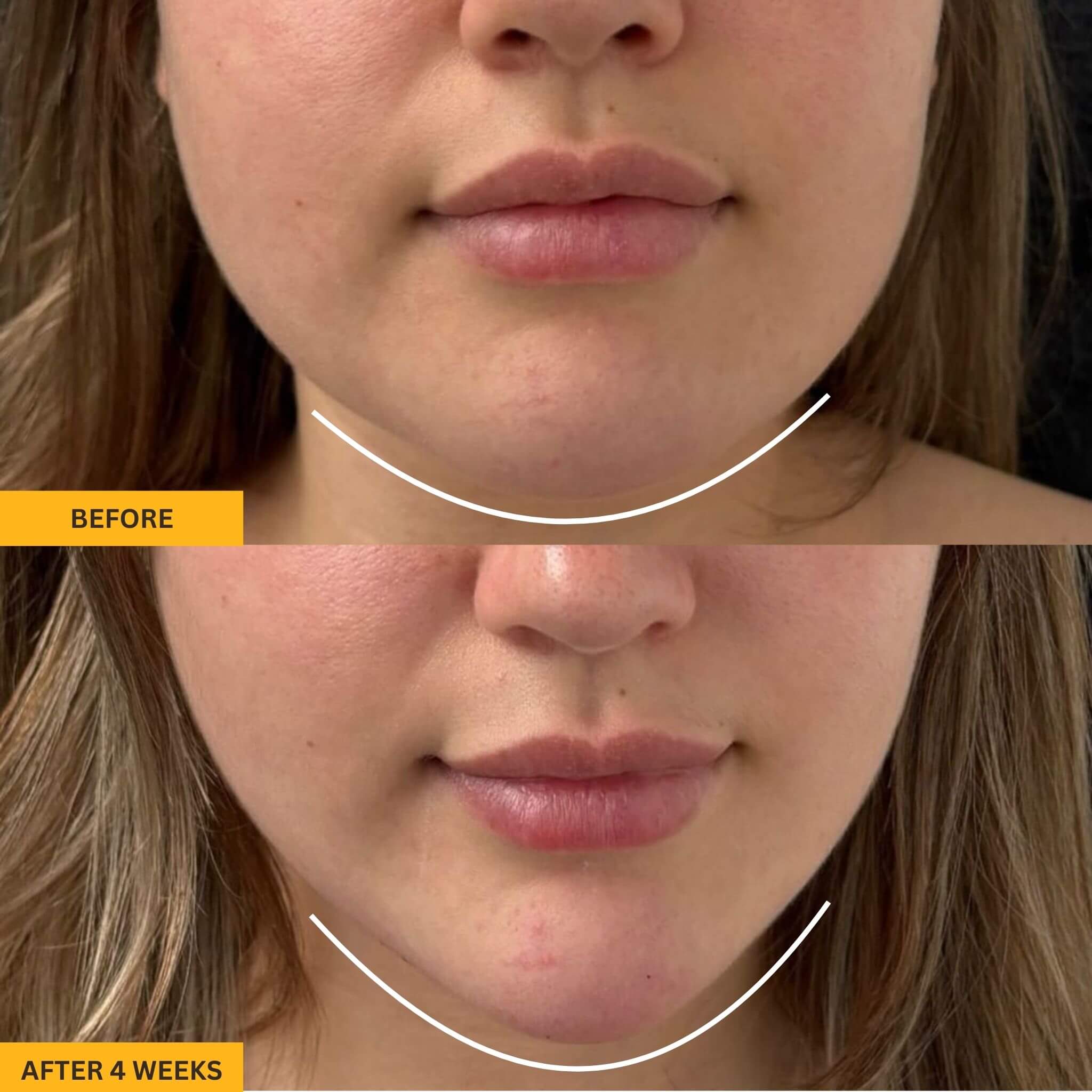 Valéa Lymphatic Brush