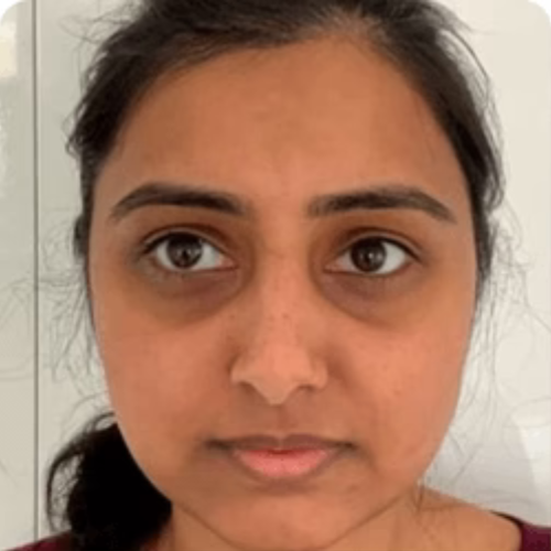 Before transformation