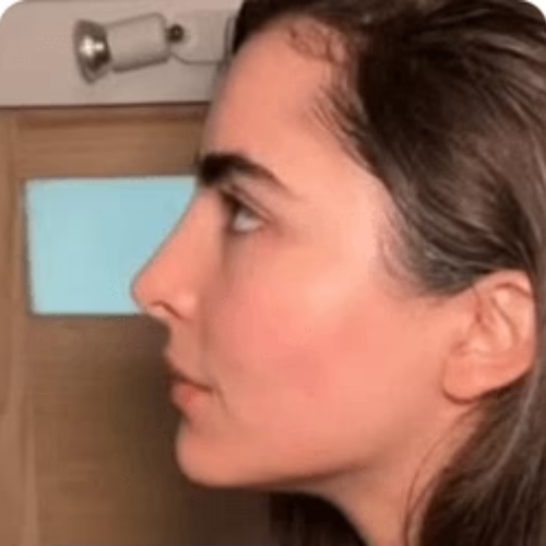 After transformation