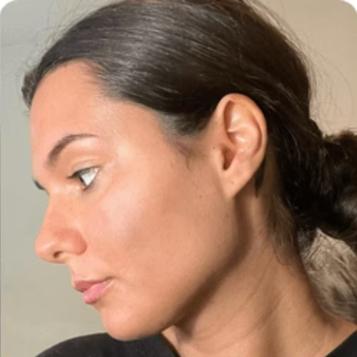 After transformation