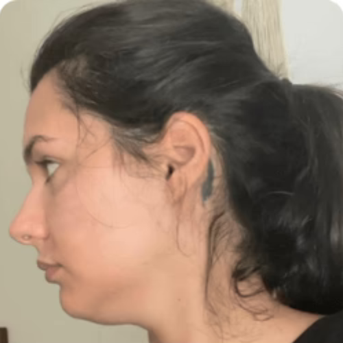 Before transformation