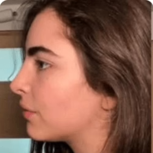 Before transformation