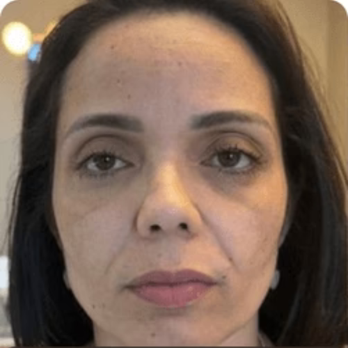 Before transformation