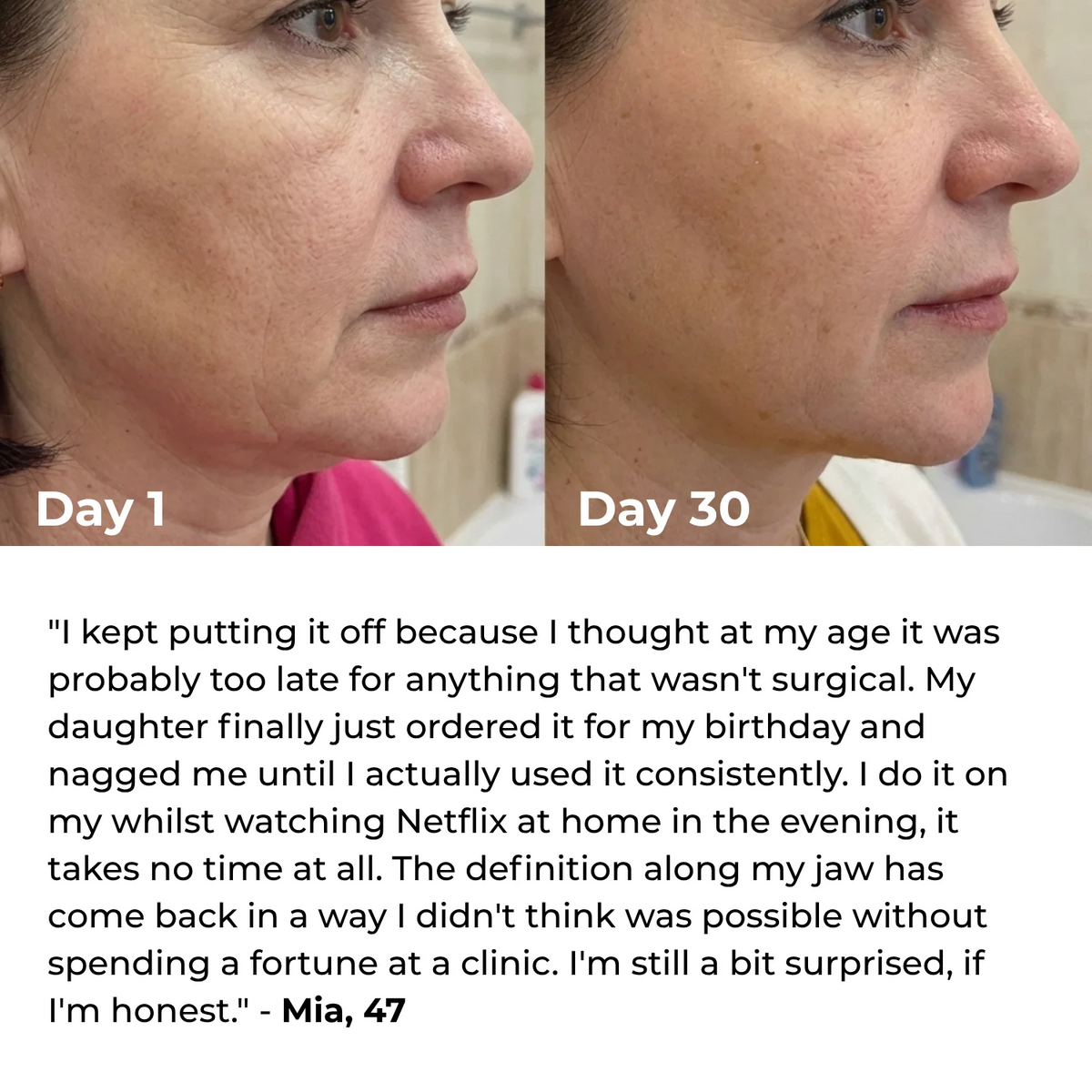 Valéa EMS Neck Lifting & Tightening Device